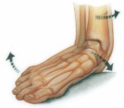 Flat feet and on sale pronation